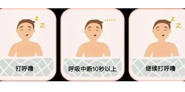 你真的了解睡眠呼吸暫停嗎？6600萬中重度患者正在受害！—仟龍醫(yī)療