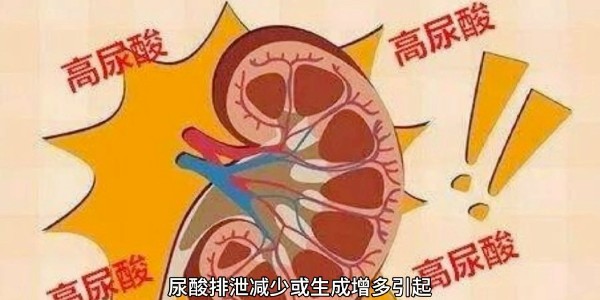 突然痛風？別再只怪啤酒和燒烤！真正的“尿酸元兇”遠比你想的多！